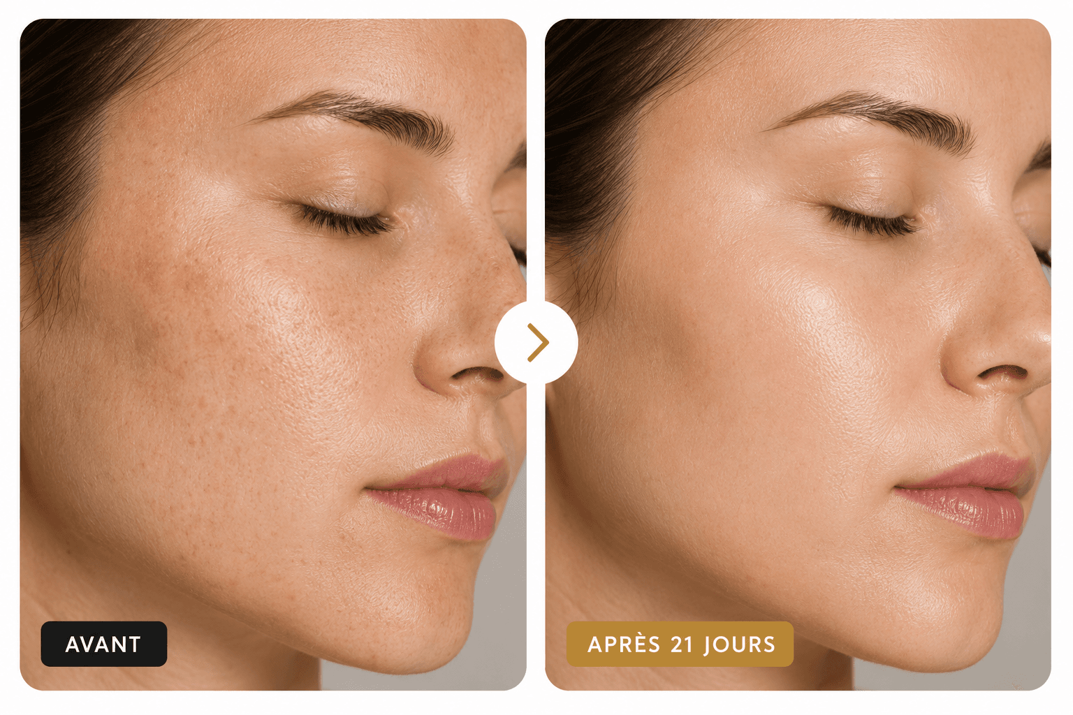 Résultats avant/après 21 jours - Nettoyant Purifiant Anissa Cosmetics